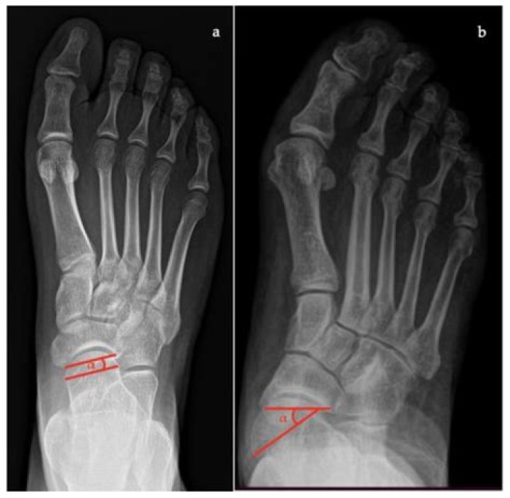 Uncovering The Height Of The Notable Actress